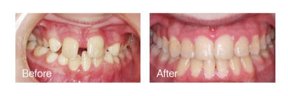 smile gallery photo