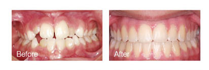 smile gallery photo
