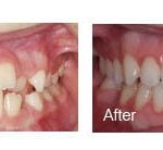 smile gallery photo