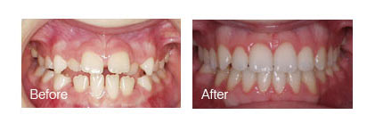 smile gallery photo